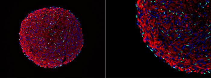 Microscopy image of a skeletal muscle organoid