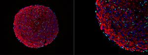 Microscopy image of a skeletal muscle organoid