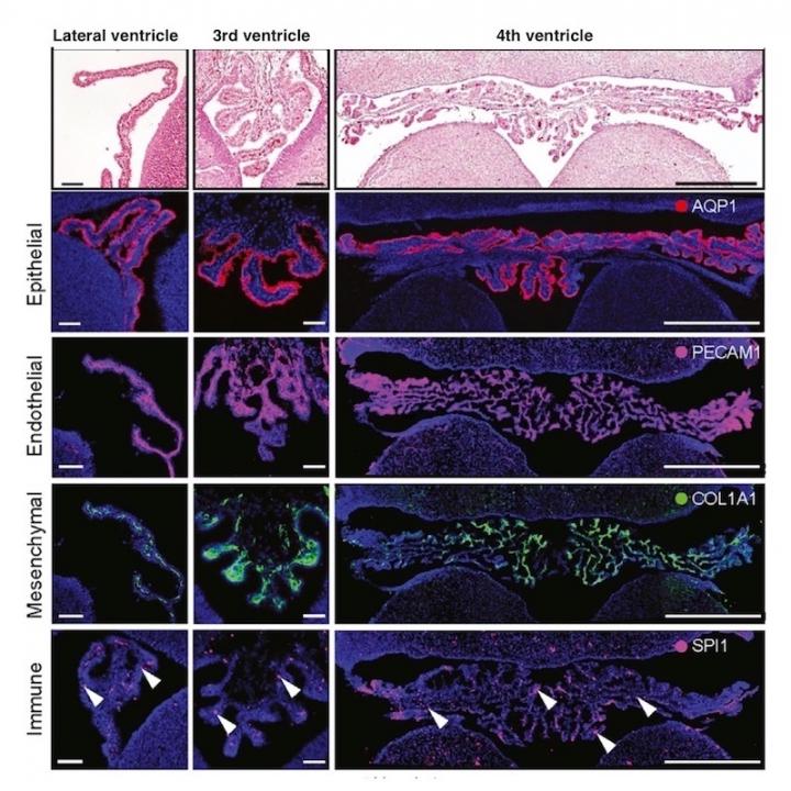 An inventory of cell types in the choroid plexus