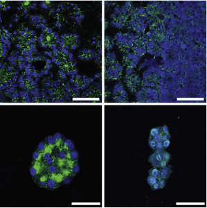 Immunofluorescence characterization of parathyroid organoids