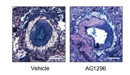 Improving lung artery function