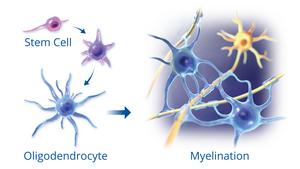 Newly Identified Lipid in Breast Milk Might Reduce Cerebral Palsy in Infants