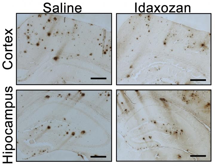 Toxic Protein Hijacks Norepinephrine to Drive Alzheimer's Disease (1 of 2)