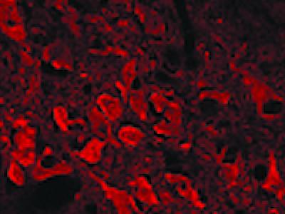 Some Autism Behaviors Linked to Altered Gene