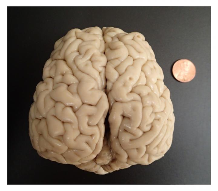 Juvenile California Sea Lion Brain