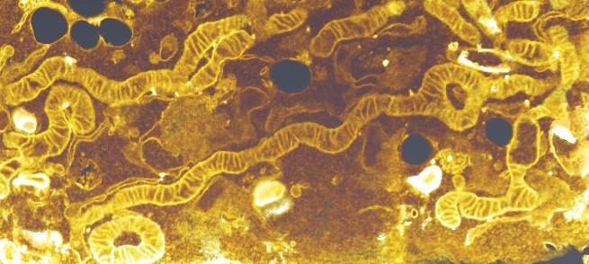 Mitochondrial Elongation