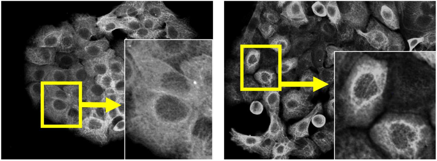 TRIM29 Knockdown and Keratin Distribution