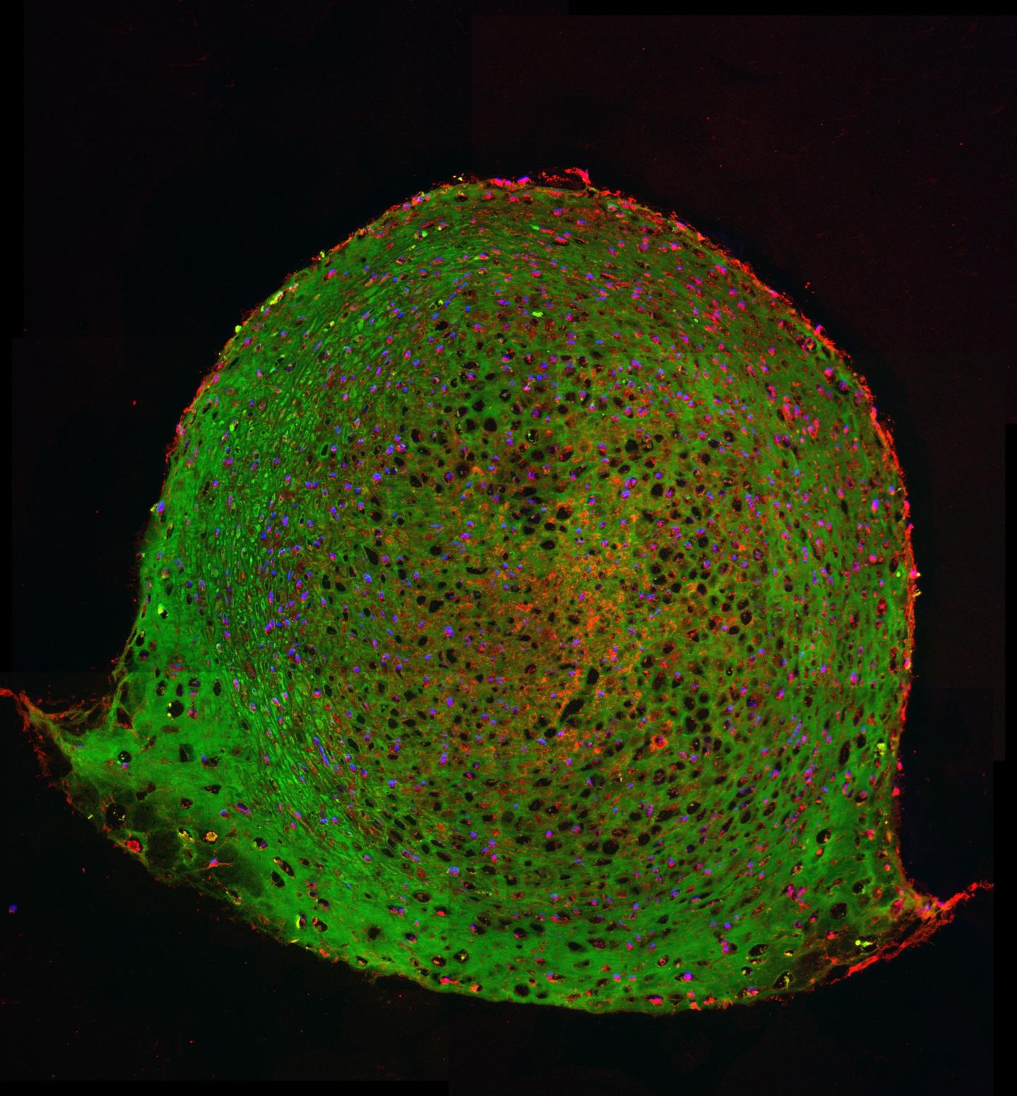 Doing More with Less