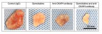 Fig. 2: Anti-Tumor Effect of the Anti-CKAP4 Antibody in a Pancreatic Cancer Model