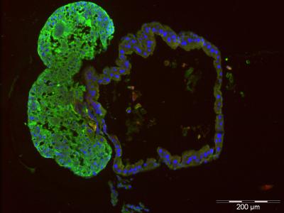 How Beetles Keep Bacteria in Check (4 of 15)