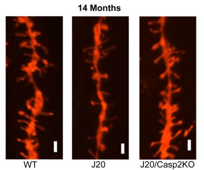 Dendritic Branching in Mice