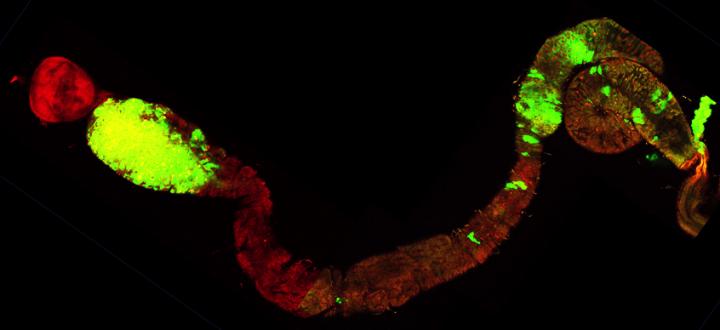 Tube digestif de mouche Drosophila melanogaster présentant des cellules tumorales