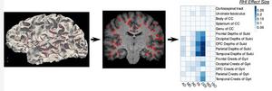 Diffusion MRI