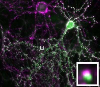 Nerve Cells Communicate in a Cell Culture