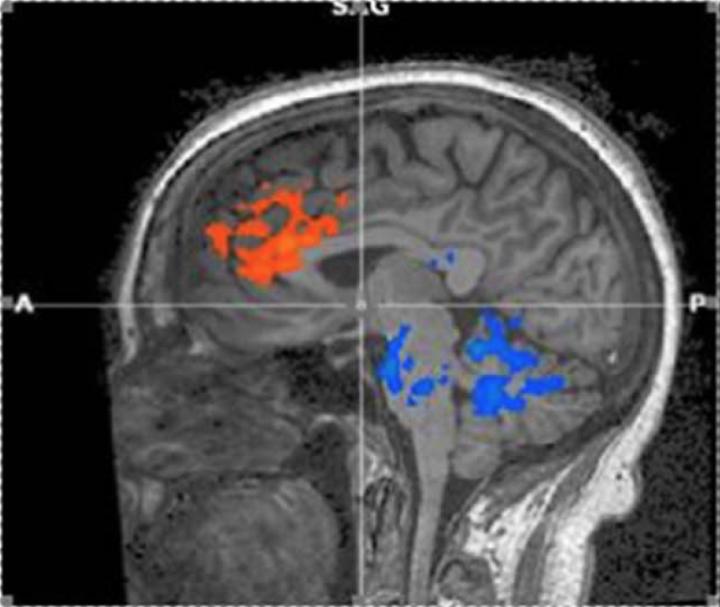 Areas of Activation During Transcendental Meditation