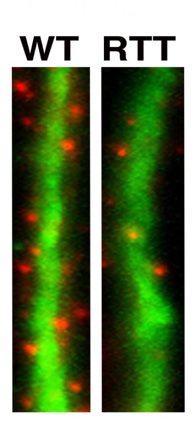 Modeling Autism in a Dish (2 of 2)