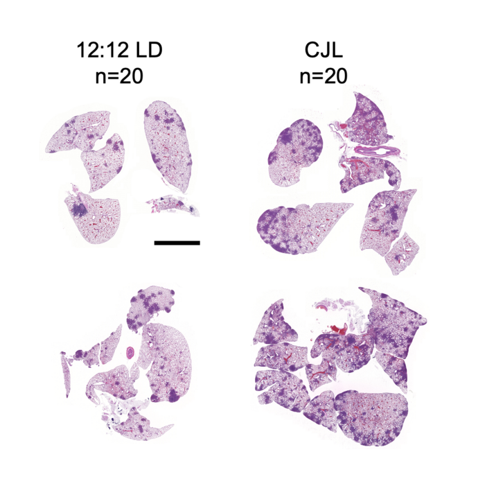 Tumor growth in chronic jet lag conditions