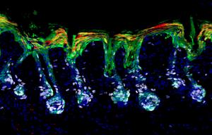 Hair follicle stem cells