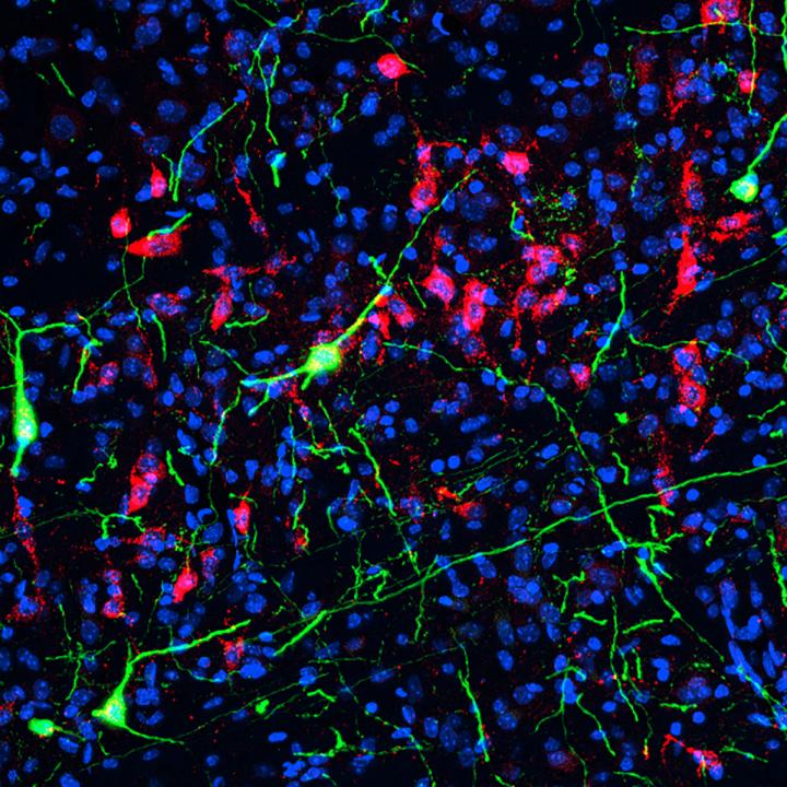 Uncovered: Neurons that Influence Stressed Versus Calmed States (1 of 3)