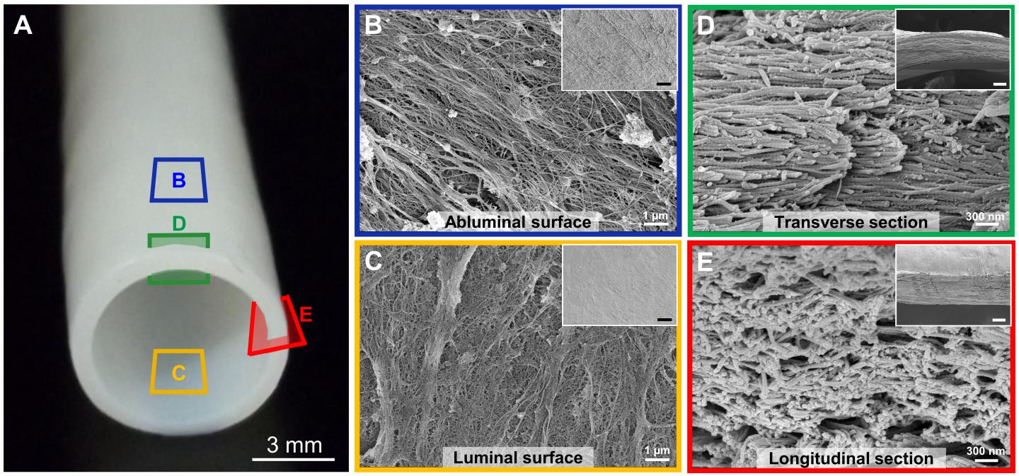 Self-Sustaining, Bioengineered Blood Vessels Could Replace Damaged Vessels in Patients (1 of 2)