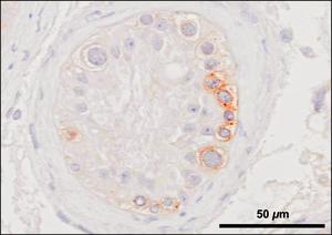 Jumping genes (brown stain) attacking germ cell DNA (blue stain)