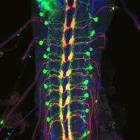 Tracing Down-And-Back Neurons in the Ventral Nerve Cord