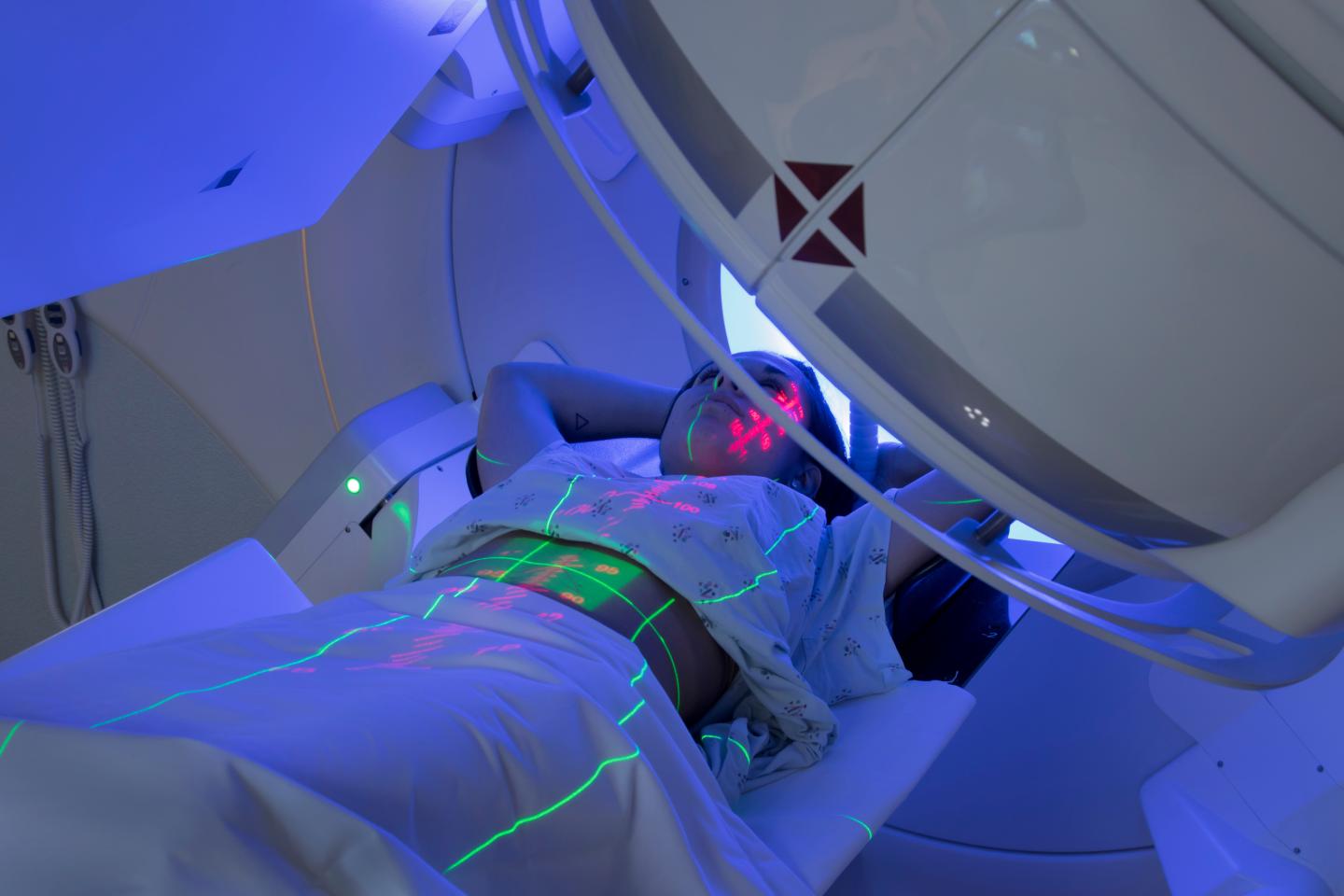 The Pros and Cons of Radiotherapy: Will It Work for You?