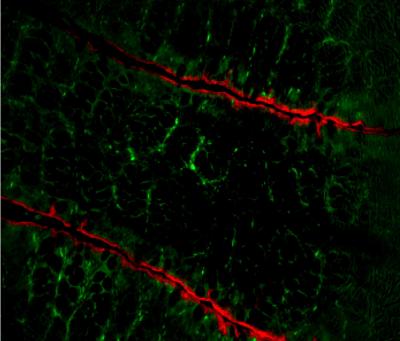 Drug Coaxes Colon Cancer Cells to Death (3 of | EurekAlert!