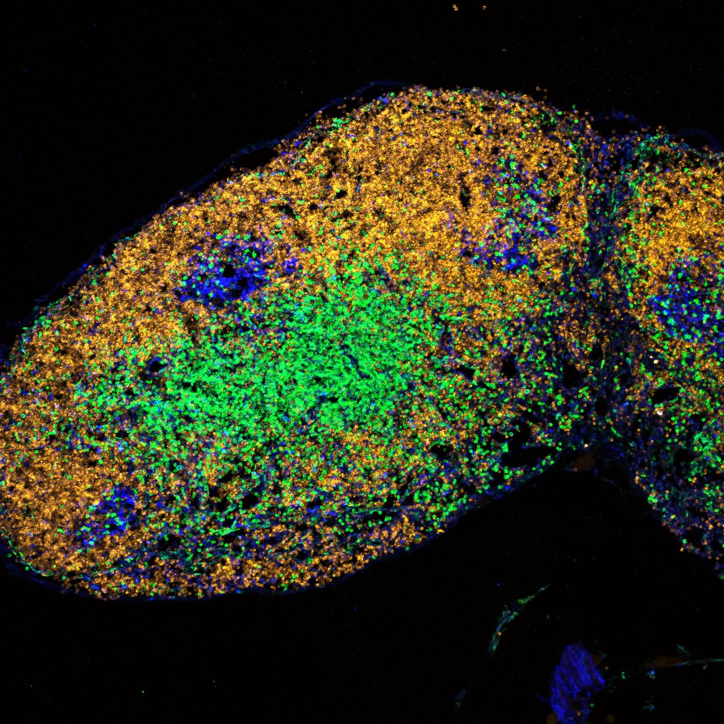 Lymph Node from a Young Mouse Post Vaccination