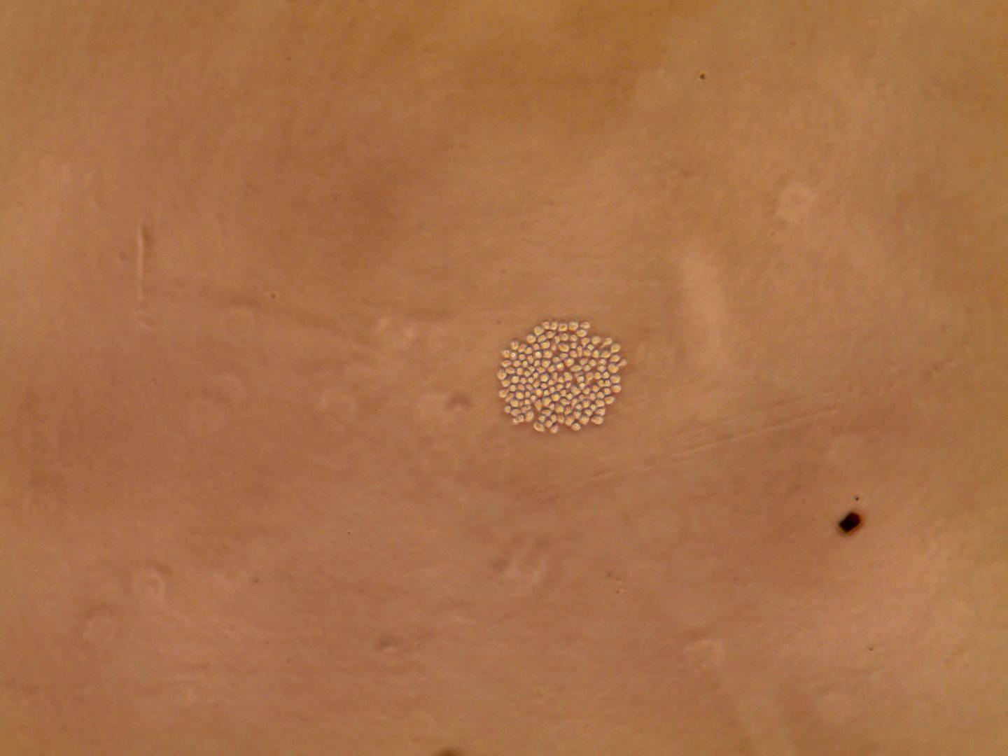 Haematopoietic Stem Cells Taken from Bone Marrow and Isolated