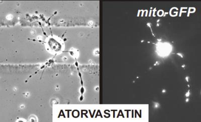 Statins Cause Mitochondria to Pile Up