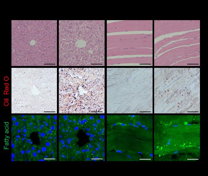 Figure 3 Depletion of Angiopoietin-2 from fat cells drives fat accumulation in other fat depots and abdominal organs.