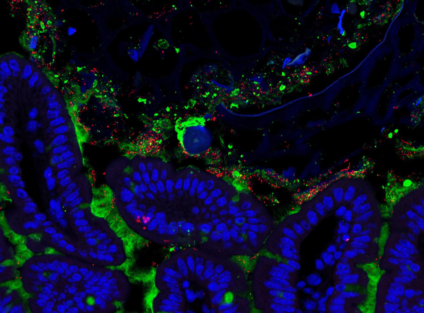 Drug Mimics Viruses to Fight Antibiotic-Resis | EurekAlert!