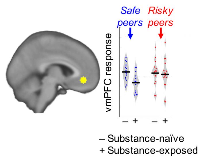 Teen Brains