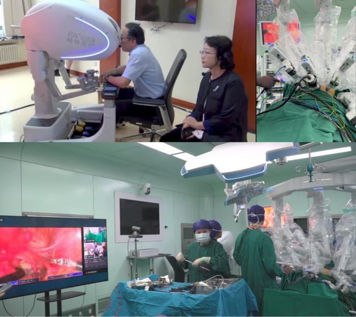 The surgical team and the Edge Multi-Port Endoscopic Surgical Robot MP1000 (Edge MP1000) surgical system