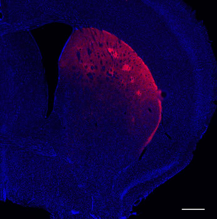 Dopamine neuron