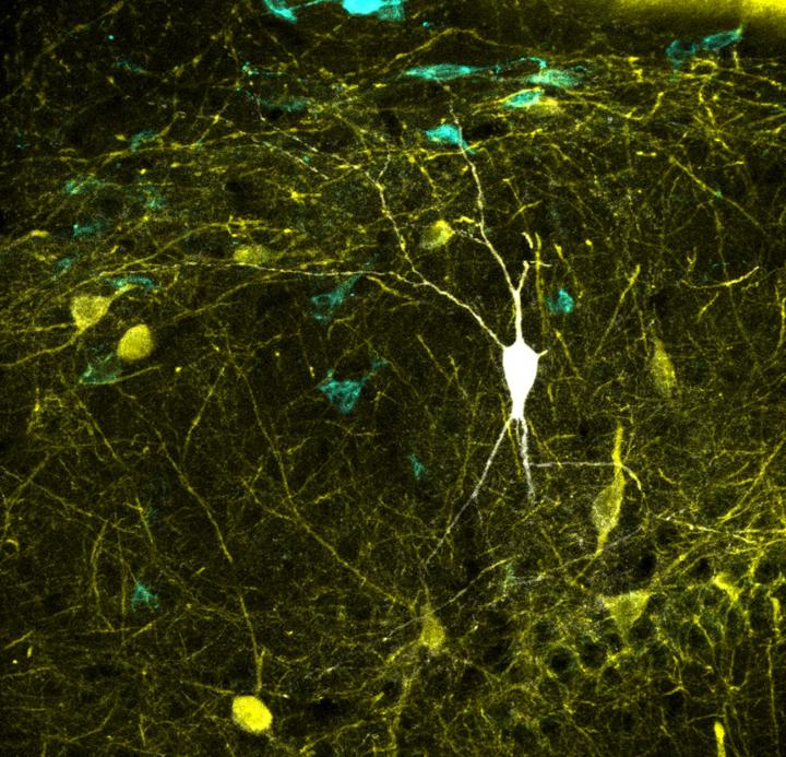 Inhibitory neuron