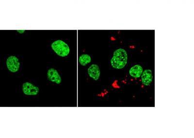 Small RNAs Behind Cell Death from Fat and Sugar Overload