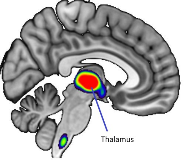 nicotine addiction brain