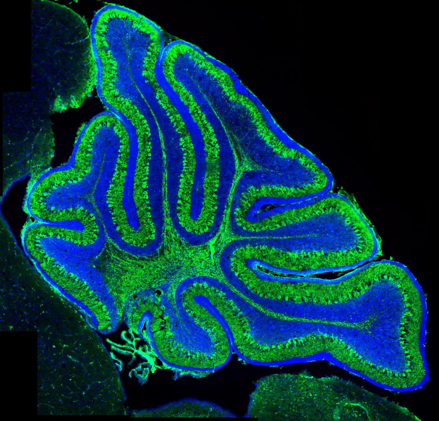 Mouse Cerebellum [IMAGE] | EurekAlert! Science News Releases