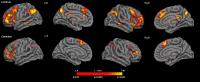 Cannabis Consumers Show Greater Susceptibility to False Memories