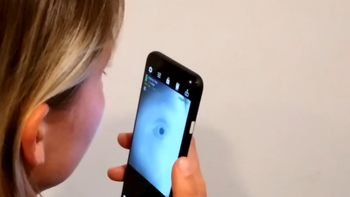 Eye-catching smartphone app for neurological screening - 1