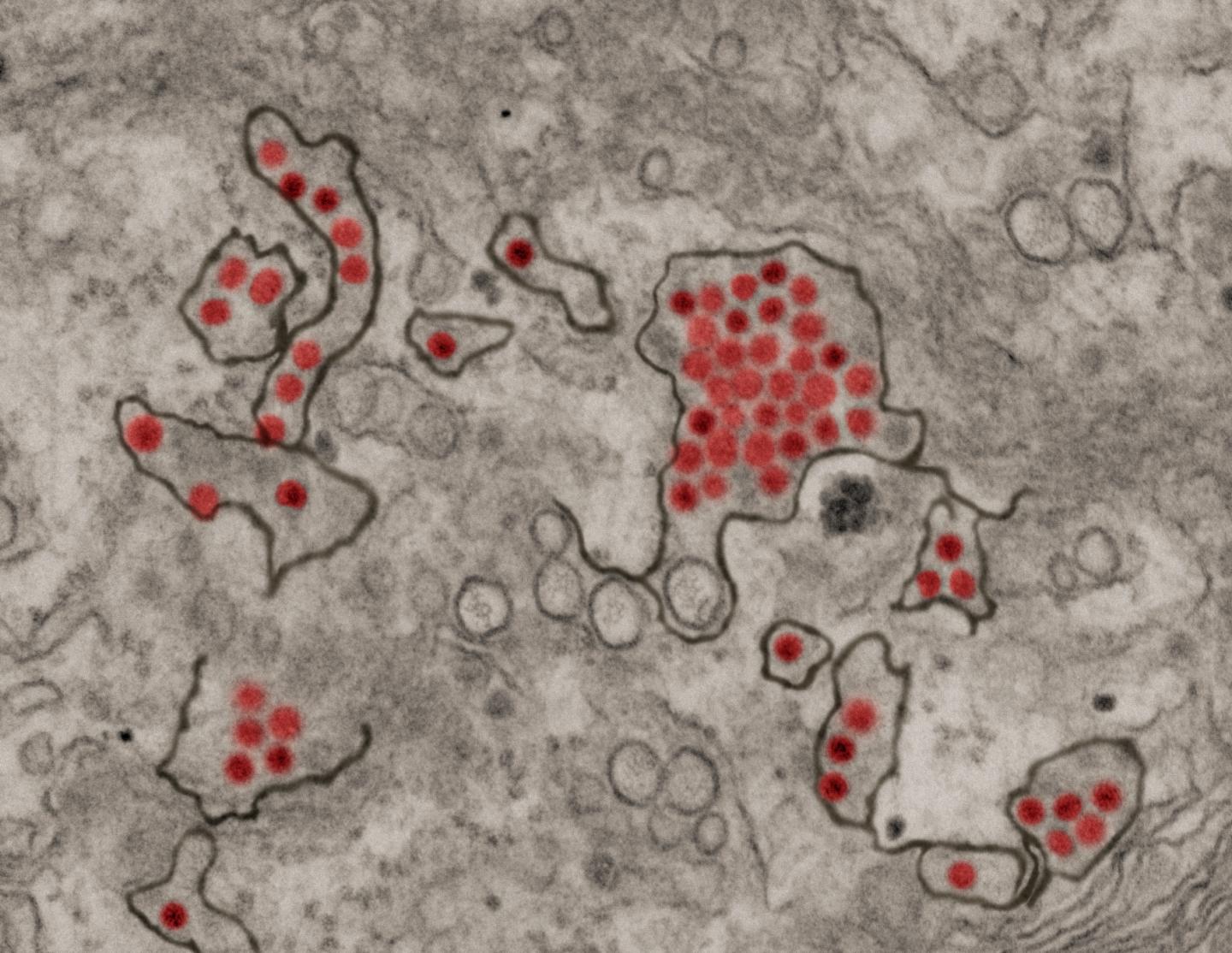 Zika Virus Particles (Red) Shown in African Green Monkey Kidney Cells