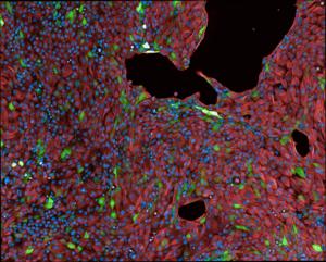 epithelial cells