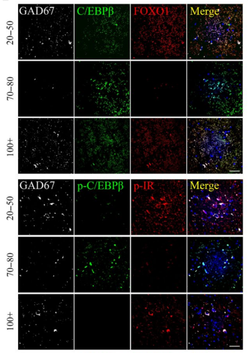 C/EBPβ mediates insulin/FOXO1 signaling in nerve cells in human brains and is inversely correlated with life span