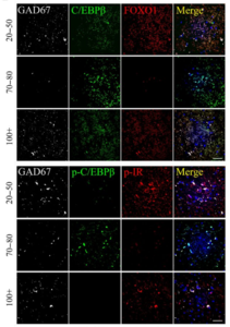 C/EBPβ mediates insulin/FOXO1 signaling in nerve cells in human brains and is inversely correlated with life span