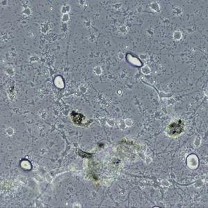 Image of amoebae