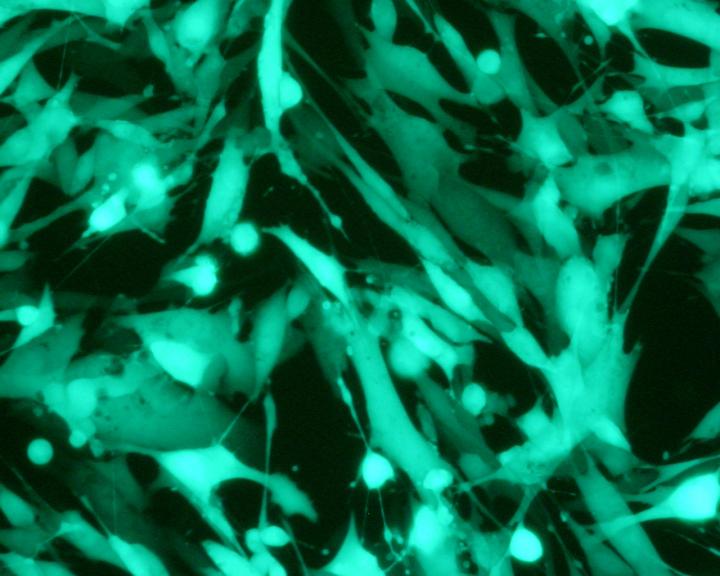 Venezuelan Equine Encephalitis Virus