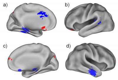 Changes in Brain Connectivity