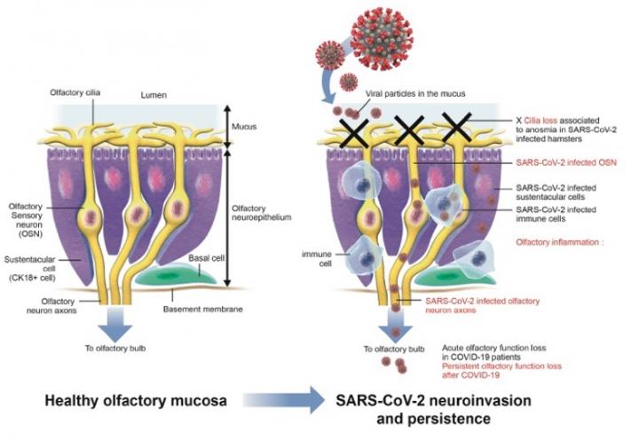 Diagram representing the various steps occurring in the sensory system and contributing to COVID-19-related anosmia.